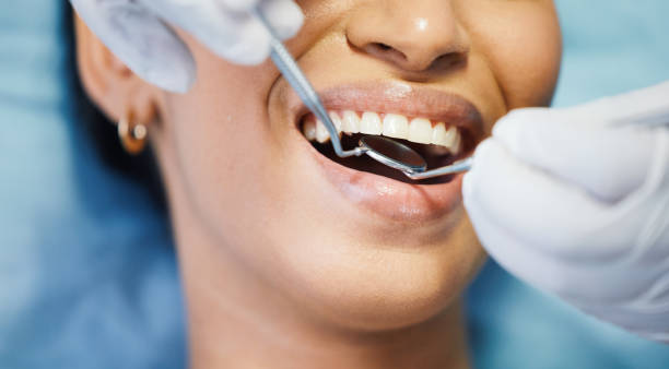Best Emergency Treatment for Dental Infections or Abscesses in Vassar College, NY